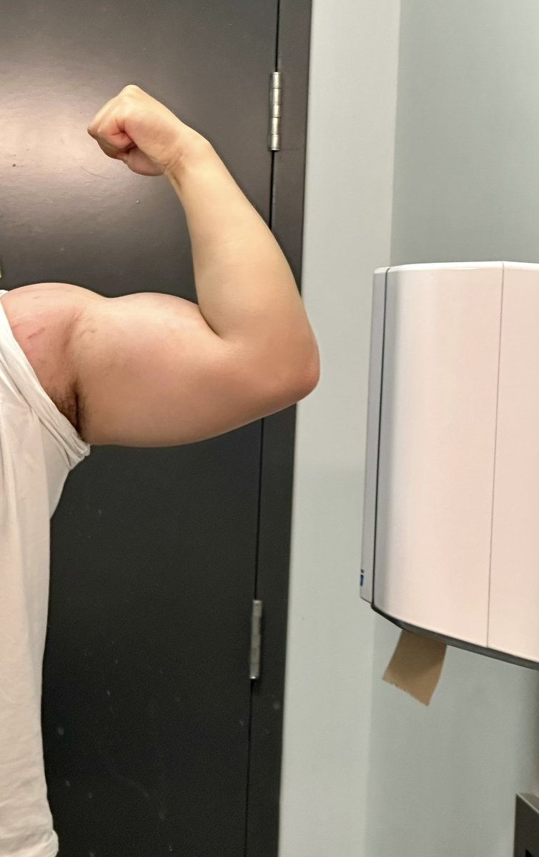 开始减脂了趁还有肥肉卖卖脂肪臂