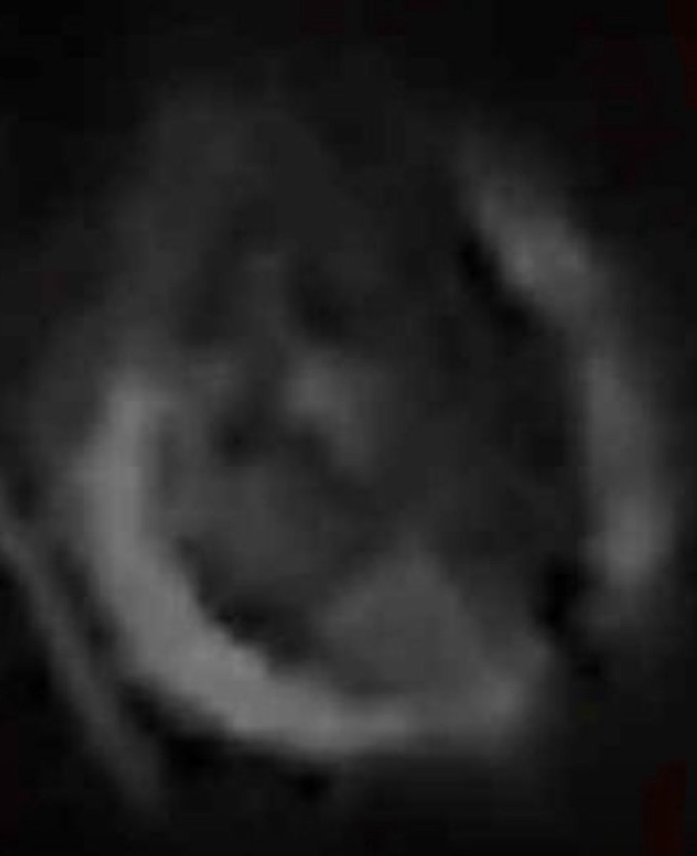 Someone sent us an Orb. What do you see?