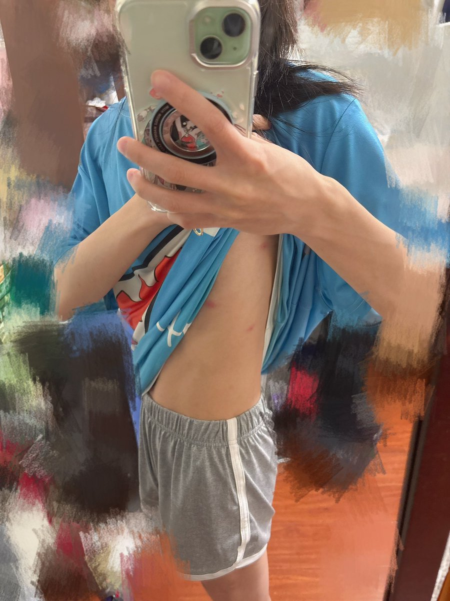 zzugerger's tweet photo. 到底是什麼東西連衣服裡面也可以咬😡
被咬的到處都是🫠 https://t.co/LwUbqzsKDO
