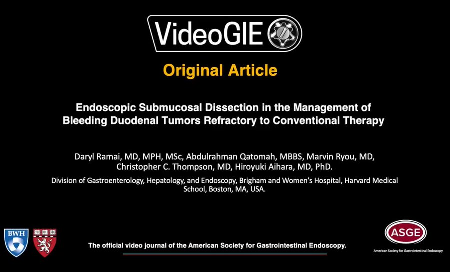 Daryl Ramai, MD, MPH, MSc. (@darylramai) on Twitter photo 🔍 New case in <a href="/videogie/">VideoGIE Journal</a>
An isolated duodenal hamartoma causing recurrent GI bleeding - managed with ESD 🔪 after failed EMR
📝 En bloc + segmented retrieval = success
📽️ Watch the technique & read the case
🔗videogie.org/article/S2468-…
<a href="/A_Qatomah/">Abdulrahman Qatomah عبدالرحمن قطومه</a> <a href="/ThirdspaceEndo/">Hiroyuki Aihara, MD, PhD</a> <a href="/MetabolicEndo/">Chris Thompson, MD</a> 🔍 New case in <a href="/videogie/">VideoGIE Journal</a>
An isolated duodenal hamartoma causing recurrent GI bleeding - managed with ESD 🔪 after failed EMR
📝 En bloc + segmented retrieval = success
📽️ Watch the technique & read the case
🔗videogie.org/article/S2468-…
<a href="/A_Qatomah/">Abdulrahman Qatomah عبدالرحمن قطومه</a> <a href="/ThirdspaceEndo/">Hiroyuki Aihara, MD, PhD</a> <a href="/MetabolicEndo/">Chris Thompson, MD</a>