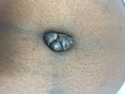 Dr Ihab Suliman tweet media