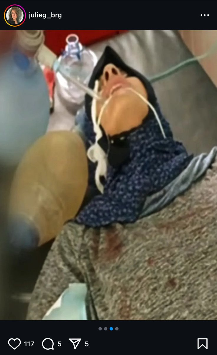 generation7_10's tweet photo. Julie relate sur Instagram les premiers instants de captivité de l’ex-otage Emily Damari, on se souvient d’elle avec ses doigts en moins. 

Témoignage de la cruauté des terroristes du 7 octobre.

Et de la complicité des civils, jusqu’aux « médecins » à Gaza. 

Cruauté complice. https://t.co/p5tJZFOJwi