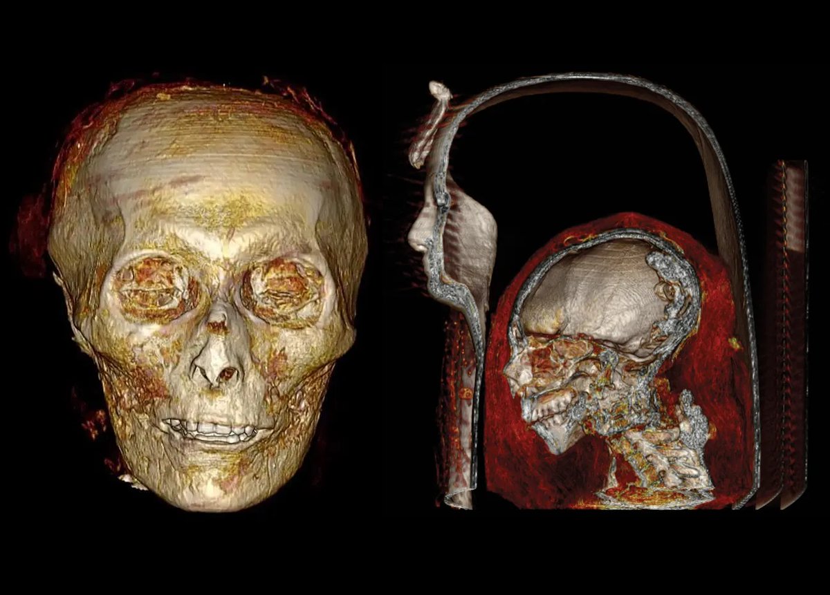 Noninvasive scans show the mummy of king Amenhotep I still within his coffin, r. c. 1526-1506 B.C.

▫️Although no cause of death could be determined, the scan of the  mummy of Amenhotep I, revealed his death to be around 35 years of age,  this conclusion came to be due to “the