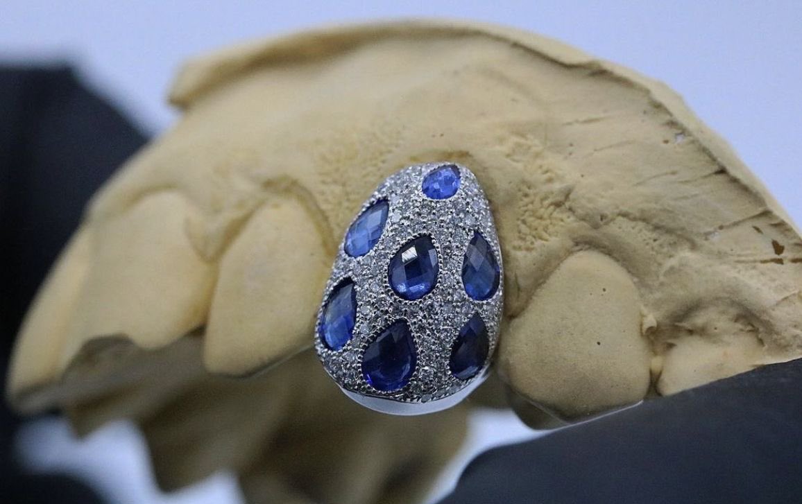 anrchhy's tweet image. Grillz