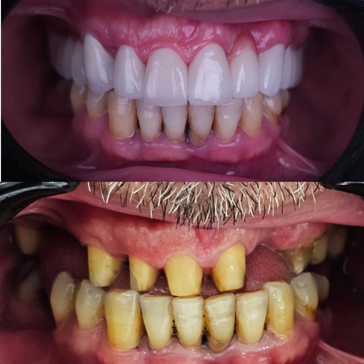 dentisTR's tweet photo. Bayramlıklar giyildi #bursa #bursada #bursadişhekimi #nilüferdişkliniği https://t.co/GwquJCocfu