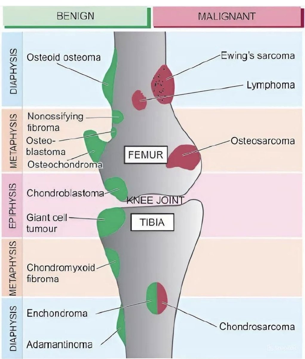 Knee lesions