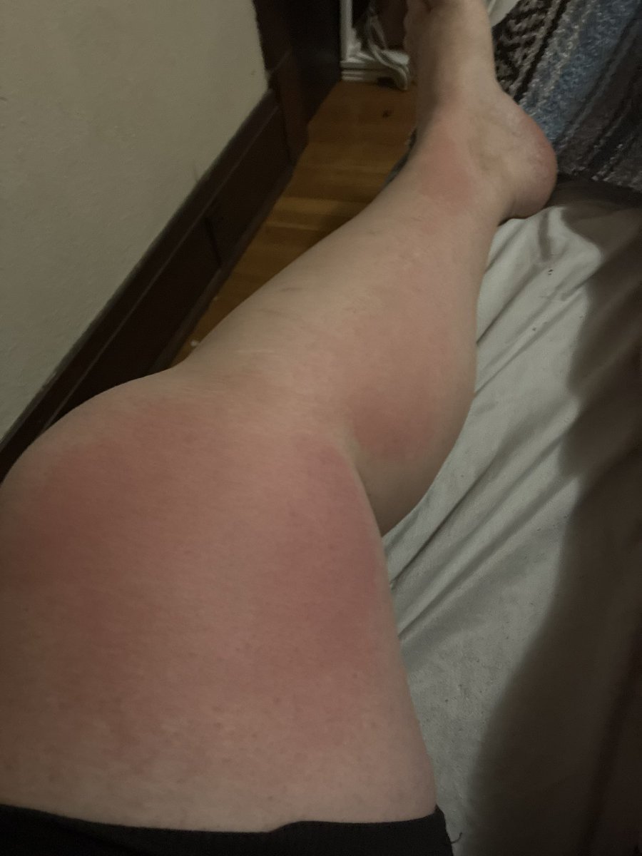 Went fishing today. It was the first time since dad died, but before that we had rarely gone since his Alzheimer’s diagnosis. I think he’d want us to take the kids fishing! Also: I’m burned.