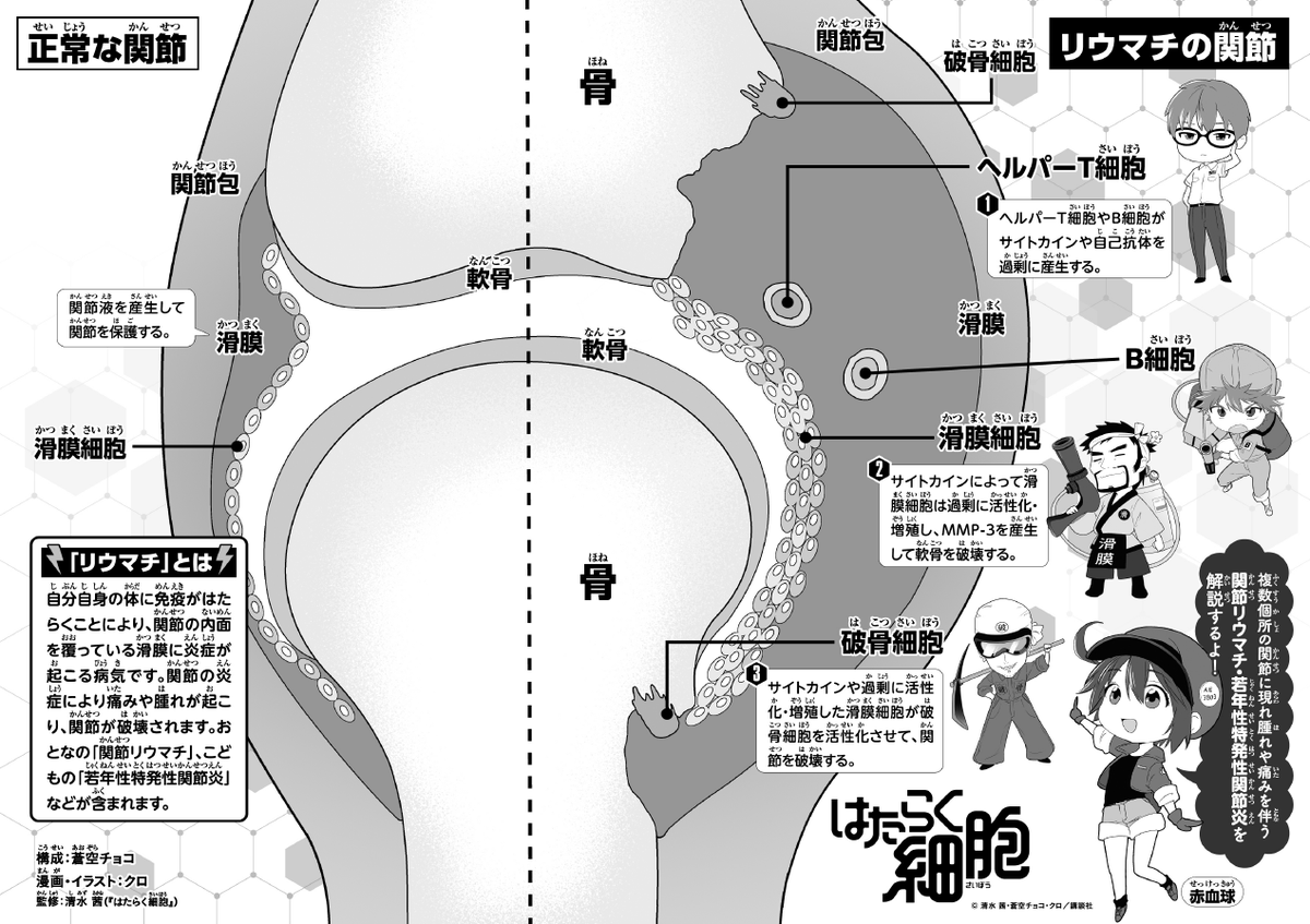 【学習資材公開のお知らせ】

厚生労働省科学研究費補助金（免疫・アレルギー疾患政策研究事業）患者視点に立ったリウマチ疾患のアンメットメディカルニーズの「見える」化と社会実装に資する研究班にて、講談社との連携により学習資材「はたらく細胞