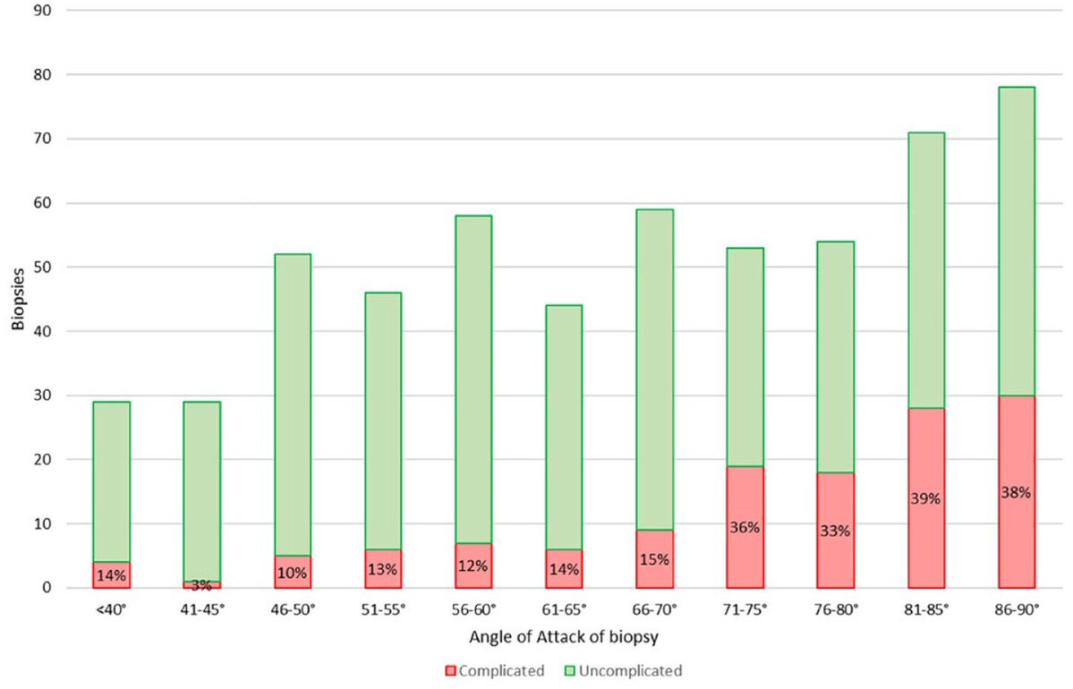 We compared kidney #biopsy outcomes before &amp; after key interventions—spanning several   years—and found fewer complications &amp; non-diagnostic biopsies with a few simple changes. What made the difference?
<a href="/CSNSCN/">CSN</a> <a href="/CanJKHD/">CJKHD</a> <a href="/usask/">U of Saskatchewan</a> 

doi.org/10.1177/205435…