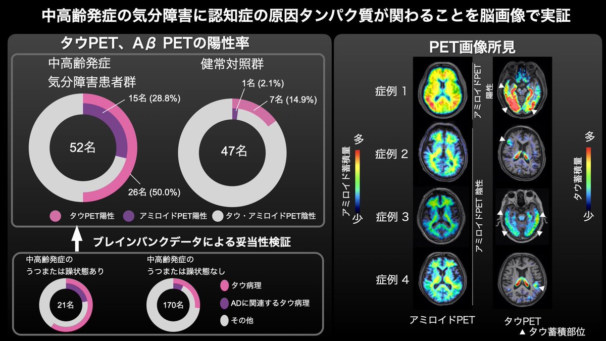 KSK@neuropsychiatry tweet media