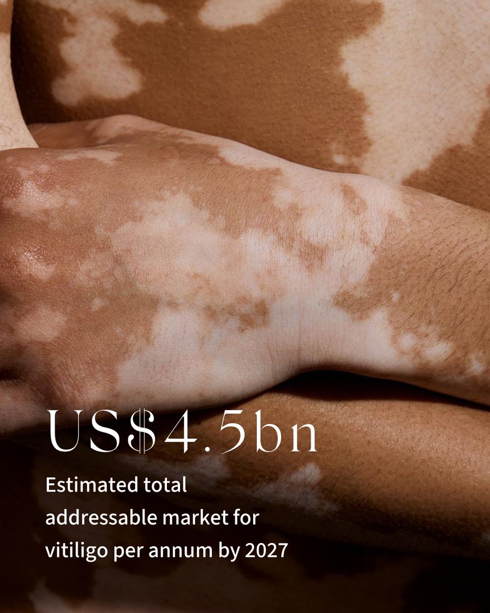 The latest CLINUVEL update on vitiligo highlights the estimated total addressable market for vitiligo treatment and the key factors to personalising treatment for patients.

Learn more in the update here: clinuvel.com/wp-content/upl…

$CUV.AX #Biotech #Biopharma #Vitiligo #ASX
