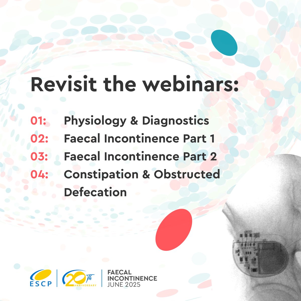 🟡 As part of #ESCPFIMonth, we’re spotlighting a key ESCP resource — the Faecal Incontinence &amp; Obstructed Defecation Webinar Series

📚 Topics include:
✅ Physiology &amp; Diagnostics
✅ Faecal Incontinence (Parts 1 &amp; 2)
✅ Constipation &amp; Obstructed Defecation
🎥 Watch on demand: