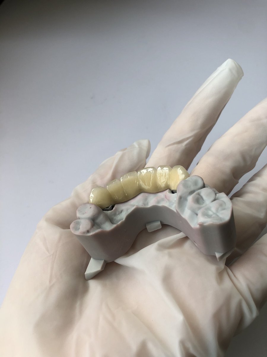 SZDiamonddental's tweet image. PFM Bridge
#3DPrinting #dentallab #fixedteeth #pfm #dental