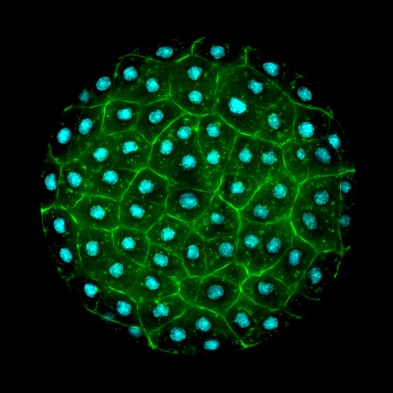 CSIC (@csic) on Twitter photo 🦠La maravillosa red microscópica que sostiene la vida en los océanos y explica el origen de los animales
🌊En la superficie puede haber más de 100.000 especies de protistas, cuyos linajes están por ubicar en el árbol de la vida
Reportaje de <a href="/AnaloCL/">Ana Lozano</a> 👇
tiny.cc/3rgm001 🦠La maravillosa red microscópica que sostiene la vida en los océanos y explica el origen de los animales
🌊En la superficie puede haber más de 100.000 especies de protistas, cuyos linajes están por ubicar en el árbol de la vida
Reportaje de <a href="/AnaloCL/">Ana Lozano</a> 👇
tiny.cc/3rgm001