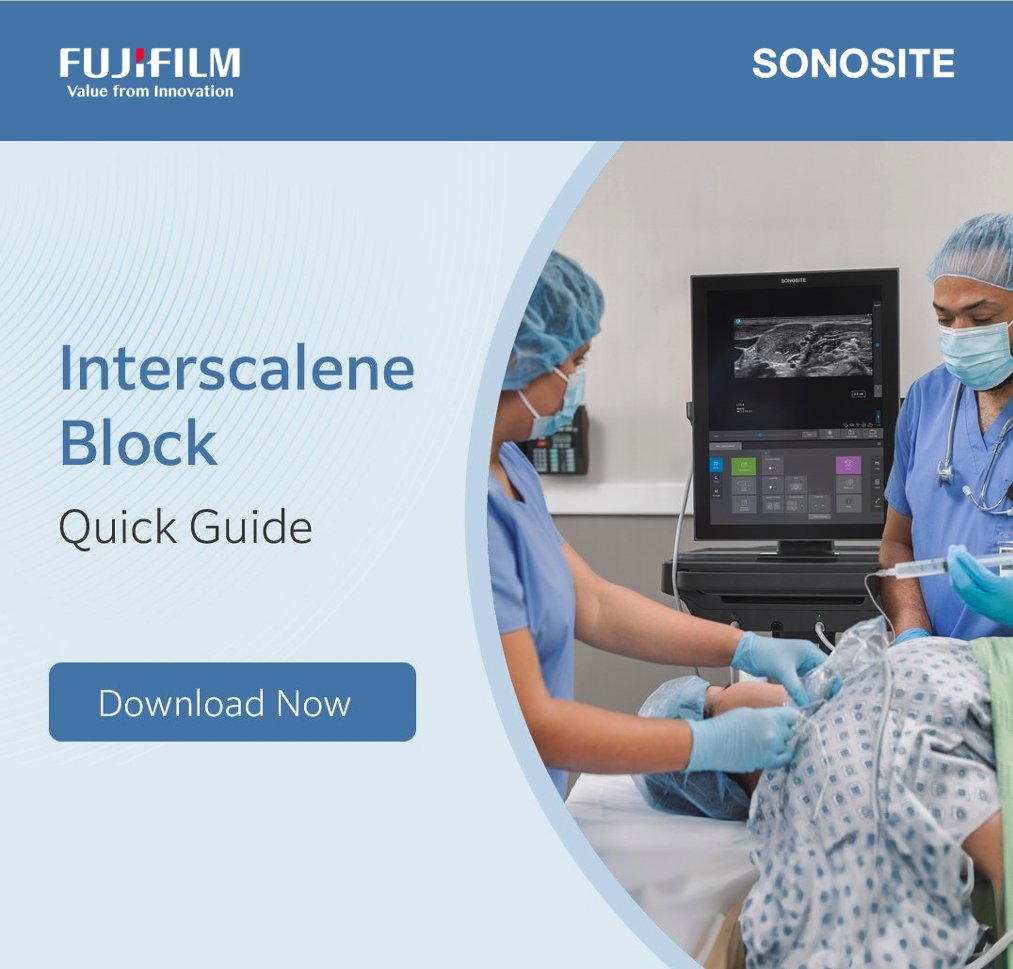 Looking to optimise patient outcomes for rotator cuff repairs and shoulder surgeries?

Our Interscalene Block Quick Guide has the sonographic anatomy and positioning tips you need for successful blocks. 

Keep it handy and download it now: brnw.ch/21wT57D