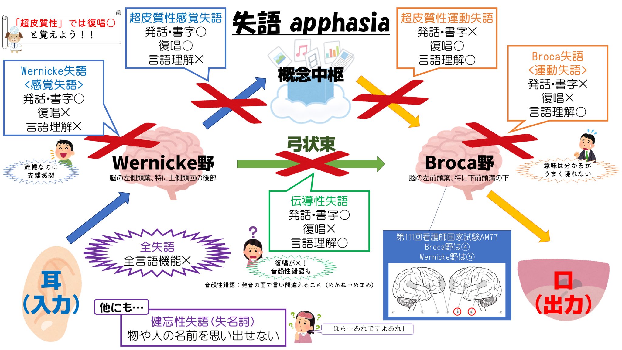 伝導失語-復唱障害、STM障害、音韻性錯語 | 日本高次脳機能障害