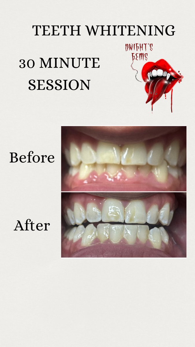 _dwights_'s tweet photo. NOW OFFERING TEETH WHITENING 🦷✨ DM ME ON IG TO BOOK
#teethwhitening #PrideMonth #toothgems #aesthetic #explorepage #dwightsgems https://t.co/Ae3qTDlGiC