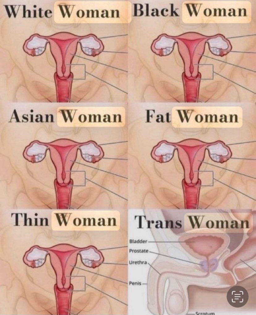 <a href="/AntiWokeMemes/">Anti Woke Memes</a> There’s nothing to explain here ! 
Unless the man they are referring to is a biological woman.  No biological man can get pregnant! PERIOD!