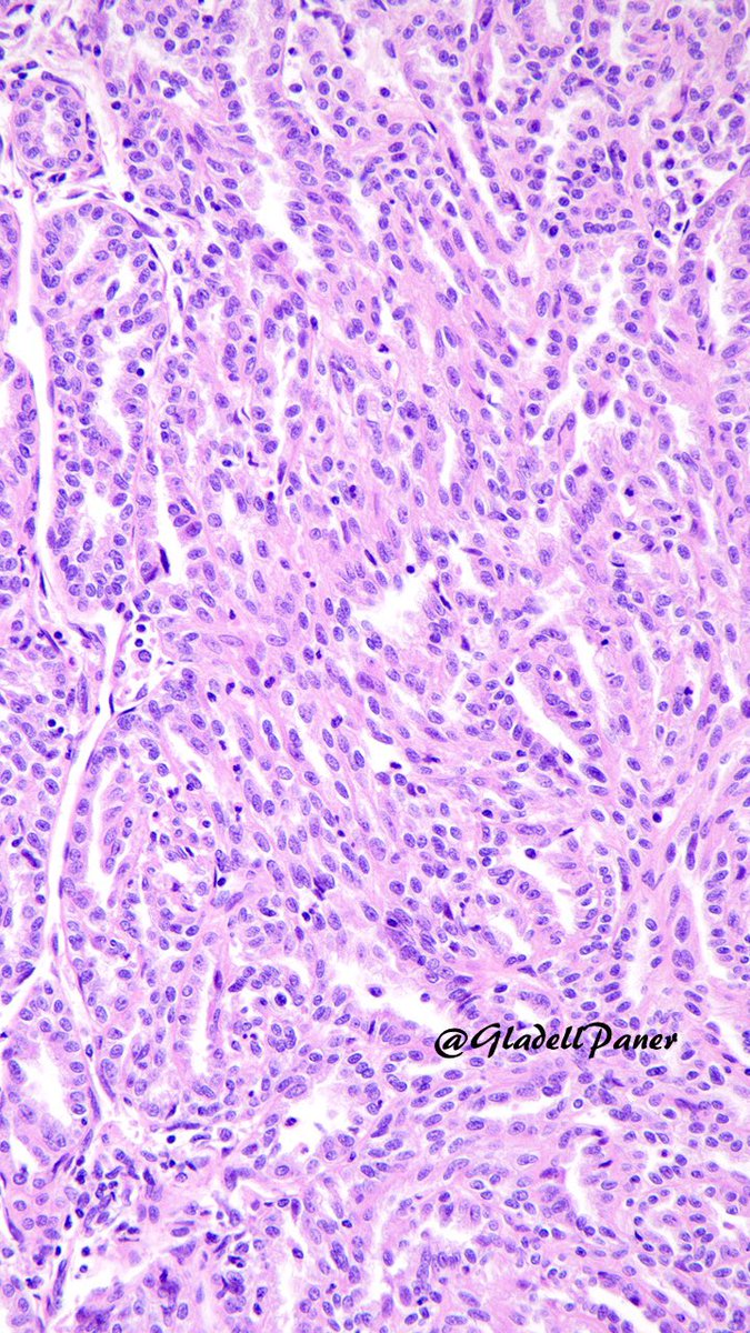 Gladell Paner, MD tweet media