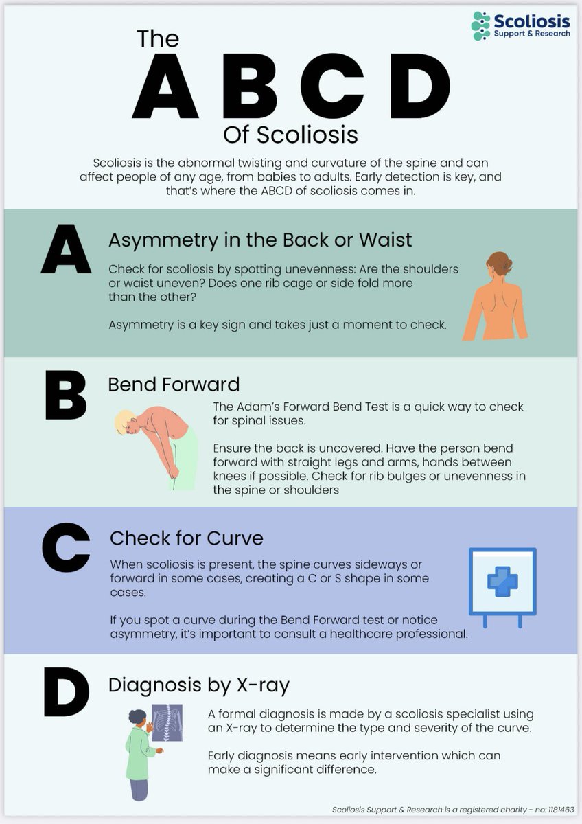 Scoliosis impacts 5% of the global population, ranging from a 10-degree curve to as severe as 130 to 140 degrees. Early diagnosis and proper treatment significantly influence outcomes.

Introducing a mnemonic - ABCD - a simple tool with global relevance. This mnemonic aligns with