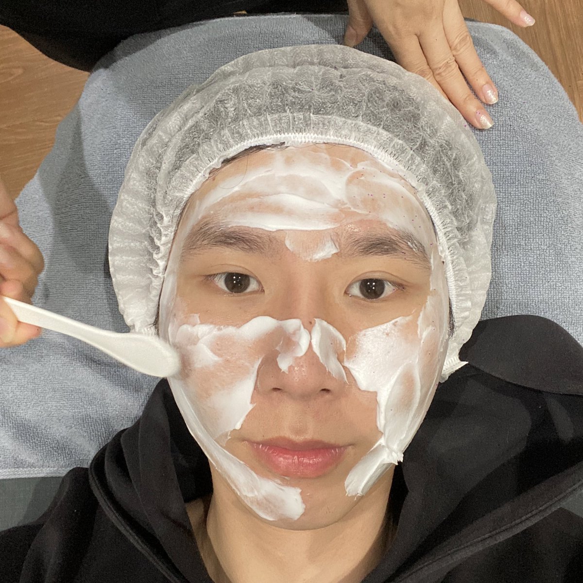 bbigkachu's tweet photo. พลีชีพ 55555 ขึ้นเตียงปั่นหน้าสุดๆ ล่าสุดไปทำ Pico กับ ฉีดโบท็อกซ์ มาโคตรจะจึ้ง!! คลินิกบริการดีมาก ก่อนทำมีแปะยาชาให้ก่อนนะ บอกเลยว่างานละเอียดมาก ที่ชอบคือหน้าไม่เป็นแผลแบบที่เคยเห็นนะแค่มีรอยแดงและไม่ควรโดนแดดนานนะ ราคาคือไม่แรงด้วย 10/10💕

📍 L clinic สยามสแควร์วัน ชั้น 2 https://t.co/lerEt4gpLZ