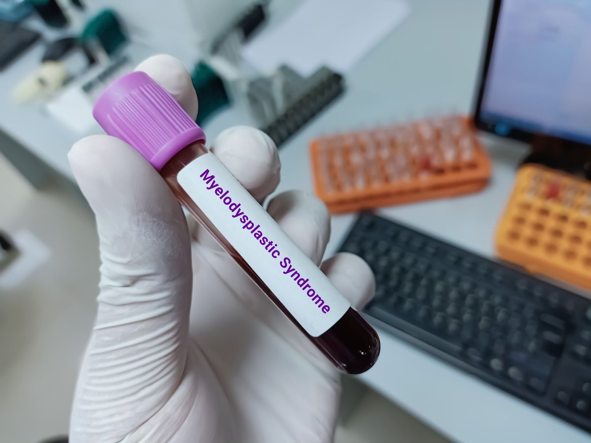 Blood Cancers Today (@blood_cancers) on Twitter photo The primary analysis of the phase 3 IMerge trial presented at #ASCO25 revealed significant efficacy with imetelstat therapy compared with placebo for patients with lower-risk #MDS.
Read more: buff.ly/VH6xQAq
<a href="/Ramikomrokji/">Rami komrokji</a> <a href="/Santin13Valeria/">Valeria Santini</a> <a href="/Dr_AmerZeidan/">Amer Zeidan MBBS,MHS عامر زيدان</a> <a href="/MikkaelSekeres/">Mikkael A. Sekeres MD, MS</a> The primary analysis of the phase 3 IMerge trial presented at #ASCO25 revealed significant efficacy with imetelstat therapy compared with placebo for patients with lower-risk #MDS.
Read more: buff.ly/VH6xQAq
<a href="/Ramikomrokji/">Rami komrokji</a> <a href="/Santin13Valeria/">Valeria Santini</a> <a href="/Dr_AmerZeidan/">Amer Zeidan MBBS,MHS عامر زيدان</a> <a href="/MikkaelSekeres/">Mikkael A. Sekeres MD, MS</a>