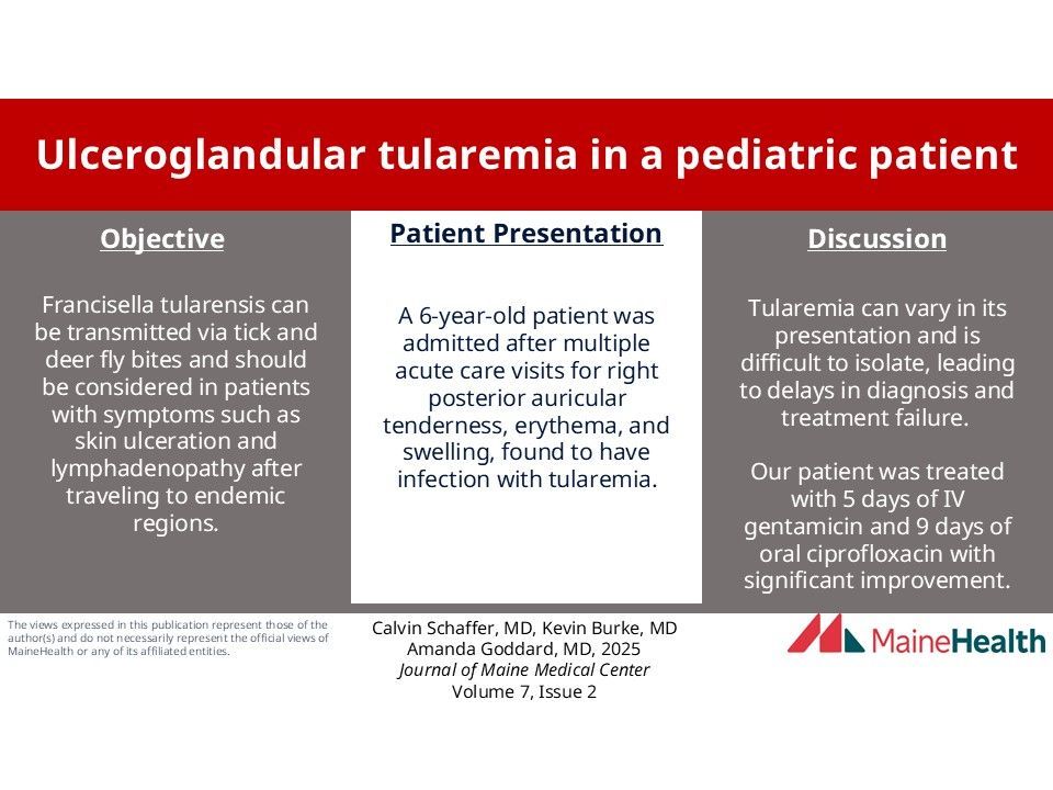 Journal of Maine Medical Center (@journalmmc) on Twitter photo A rare case of ulceroglandular #Tularemia in a #pediatric patient from #tick bite on Martha's Vineyard knowledgeconnection.mainehealth.org/jmmc/vol7/iss2…
<a href="/MaineHealth/">MaineHealth</a> <a href="/TuftsMedSchool/">Tufts School of Medicine</a> #MHMedEd @BBCHMaine #MedEd #Maine #ruralhealthcare #interprofessional A rare case of ulceroglandular #Tularemia in a #pediatric patient from #tick bite on Martha's Vineyard knowledgeconnection.mainehealth.org/jmmc/vol7/iss2…
<a href="/MaineHealth/">MaineHealth</a> <a href="/TuftsMedSchool/">Tufts School of Medicine</a> #MHMedEd @BBCHMaine #MedEd #Maine #ruralhealthcare #interprofessional