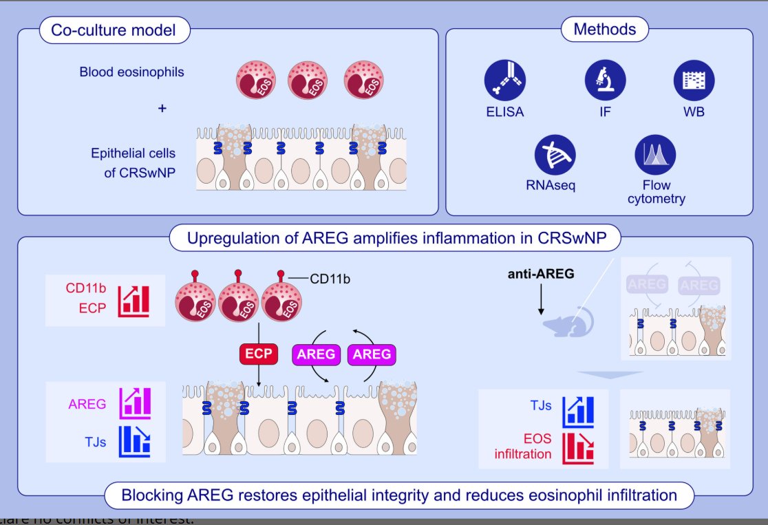 Amphiregulin Mediates Epithelial Cell–Eosinophil Interactions and Amplifies Inflammation in Chronic Rhinosinusitis With Nasal Polyps. First author: Limin Zhao; corresponding authors: Chengshuo Wang, Luo Zhang, Feng Lan

Read the article here: doi.org/10.1111/all.16…
 
This study