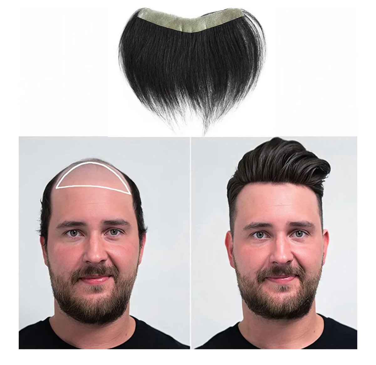 SarinGasFelon's tweet photo. hmmmm. amazon toup?? 💇🏻🧑🏼🦲🪮 #toup #grifter #bald #erectiledisfunction https://t.co/ZhZMw2aX4i