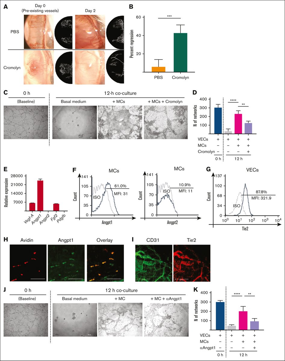 Understanding VEGF-independent mechanisms that promote the stability of pathological vessels provides an exciting avenue for exploring novel therapeutic strategies. ow.ly/P9EA50VZzpY #basicandtranslational