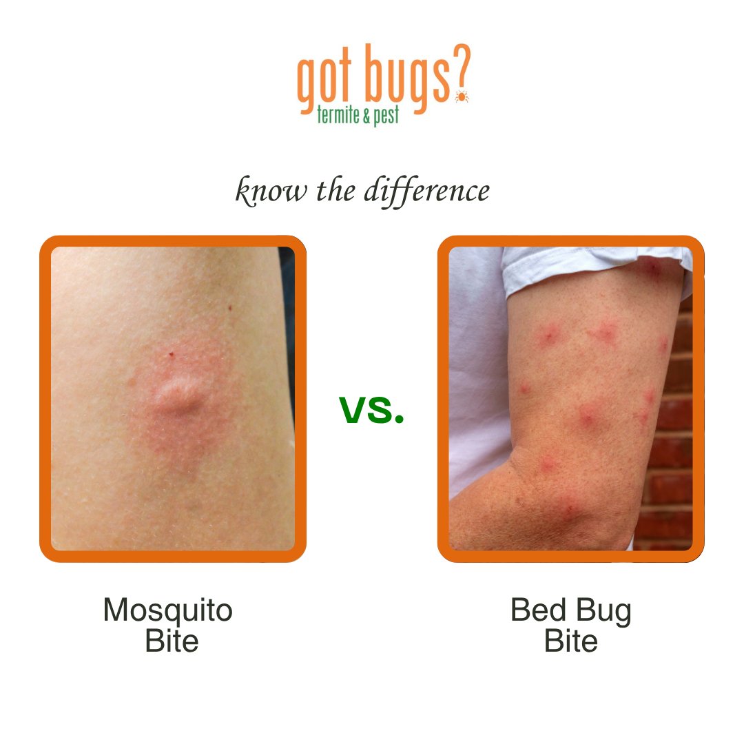 GotBugsTPS's tweet image. Think you’ve been bitten?
Don’t wait—our experts at Got Bugs? can inspect your home and confirm if bed bugs are the cause, then safely remove them.
📞 (404) 468-2847
🌐 got-bugs.com
#BedBugAwarenessWeek #PestControlExperts