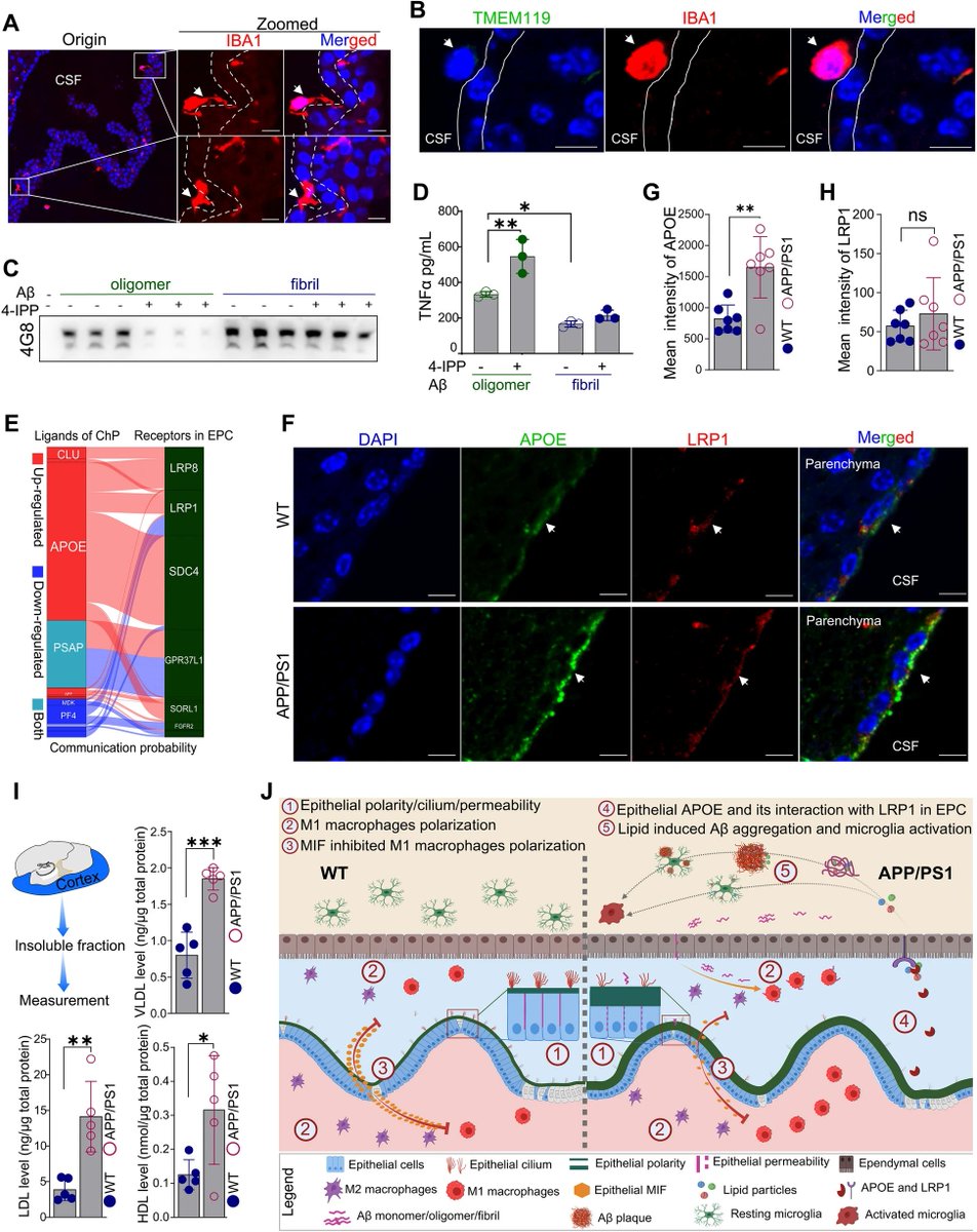 'Early #transcriptional and cellular abnormalities in choroid plexus of a mouse model of #AlzheimersDisease'

Zhong-Jiang Yan, Maosen Ye, Jiexi Li, Deng-Feng Zhang, Yong-Gang Yao

…arneurodegeneration.biomedcentral.com/articles/10.11…