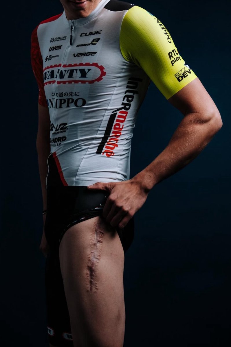 LottoWanty's tweet photo. This VICTORY means SO much 🥇🥹

Wout Geerinckx wins in Booischot after 18 months of setbacks and career-threatening injuries: fractured femur, shoulder and wrist.

Beautiful story of resilience ❤️ https://t.co/ycfXEN0HOc