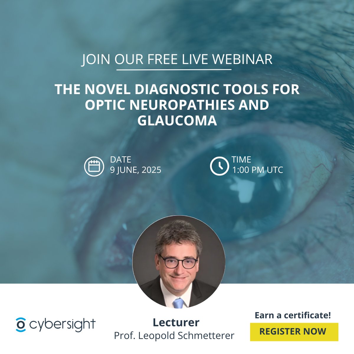 New webinar: Novel Diagnostic Tools for Glaucoma &amp; Optic Neuropathies

Learn how AI &amp; imaging are changing diagnosis, with real case studies &amp; global access insights.

📅 June 9 | ⏰ 1:00 PM UTC
🎓 Free + Certificate

🔗 Register: live.cybersight.org/register/99278…

#Cybersight #Glaucoma