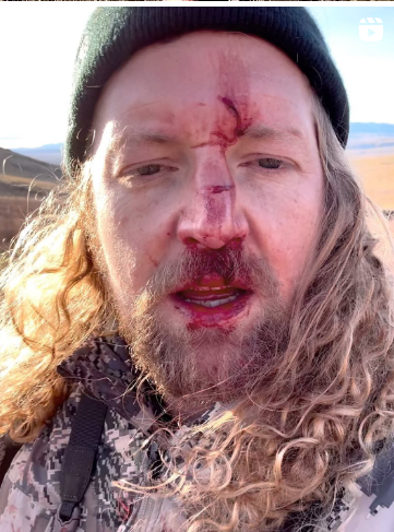 IDFreedom2's tweet image. Dude is an amateur.  #scoped