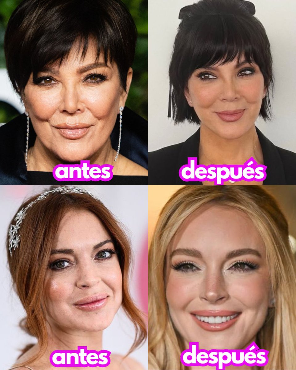 ¿Qué es el lifting líquido?: Este tratamiento estético es el secreto mejor guardado por las celebridades 😱
Levanta, define y rejuvenece, sin pausas ni vendas. Nadie notará nada... a menos que lo publiques en Instagram 👀
Aquí te contamos: link.culturacolectiva.com/5h1h