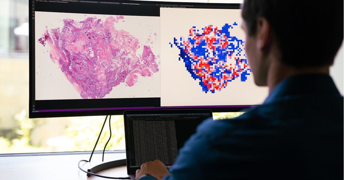 UC San Diego (@ucsandiego) on Twitter photo .<a href="/UCSDMedSchool/">UC San Diego School of Medicine</a> has developed a new Master of Advanced Studies in Precision Medicine Therapeutics in Oncology program. Classes for the new program will begin in fall quarter 2026. Learn more ➡️ bit.ly/4mIOFDa .<a href="/UCSDMedSchool/">UC San Diego School of Medicine</a> has developed a new Master of Advanced Studies in Precision Medicine Therapeutics in Oncology program. Classes for the new program will begin in fall quarter 2026. Learn more ➡️ bit.ly/4mIOFDa
