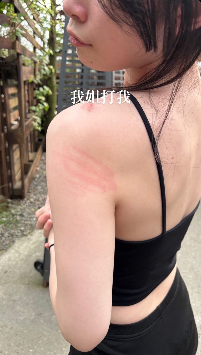 其實也不是被打
沒有擦防蚊液被叮上了😭
有誰想讓我脖子紅紅的😍🥰😘
#屏東 #高雄 #學生妹