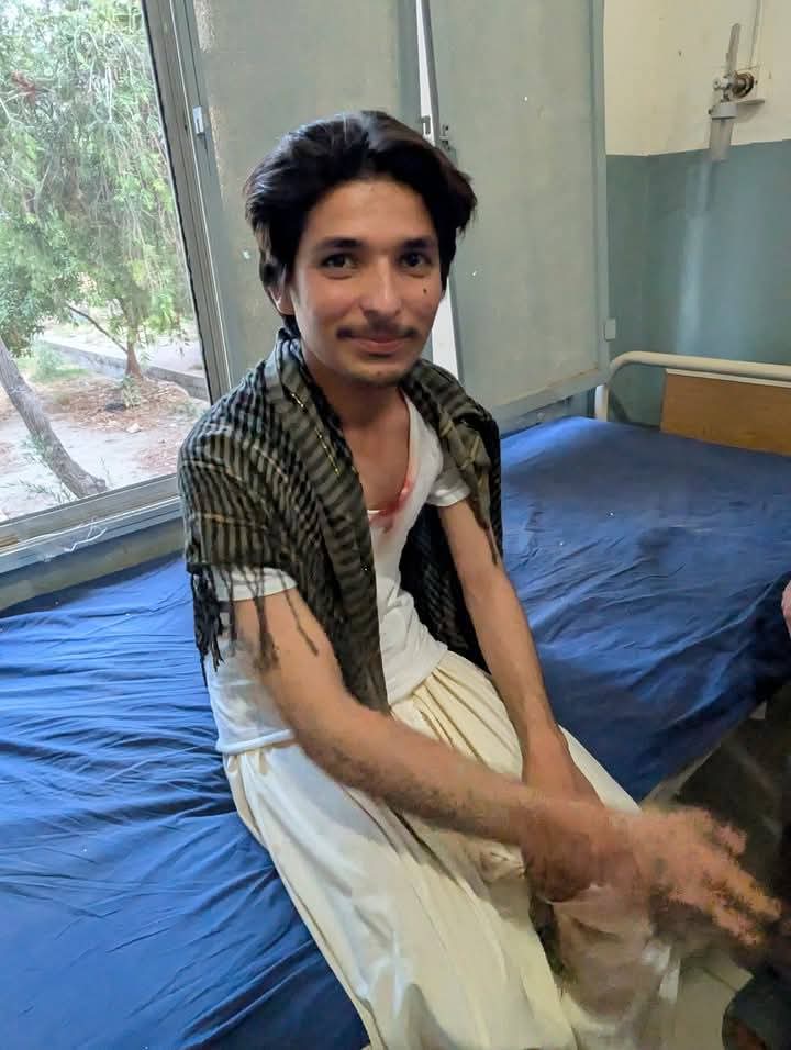 north_ptm's tweet photo. شمالي وزیرستان – میرعلي، موسکي کلی
نن په موسکي کلي کې د یو ډرون برید له امله څلور بې ګناه ماشومان ټپیان شوي دي.
دغه پېښه د سیمې خلک سخت اندېښمن کړي دي، او د ولس غوښتنه ده چې د ملکي وګړو ژوند ته دې درناوی وشي.
د امن او انصاف غوښتنه کوو.
#StopStateTerrorism https://t.co/Fx5Vq78kbx