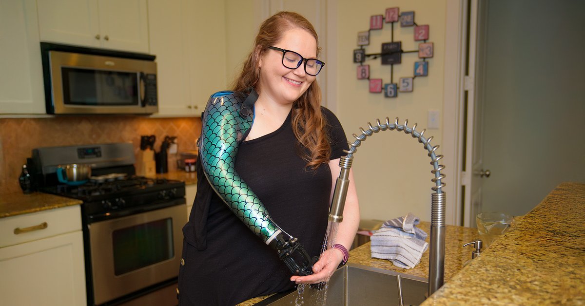 Marissa is our most recent featured patient. Head over to watch her video where she talks about what she wanted from her prosthesis:
armdynamics.com/success-storie…