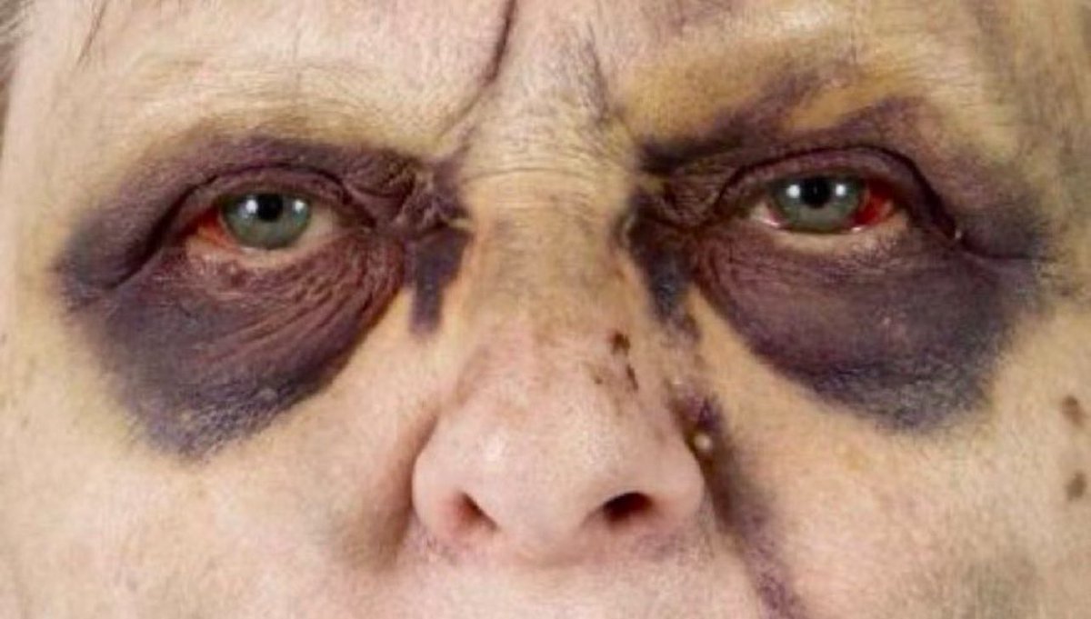 Keith Siau tweet media