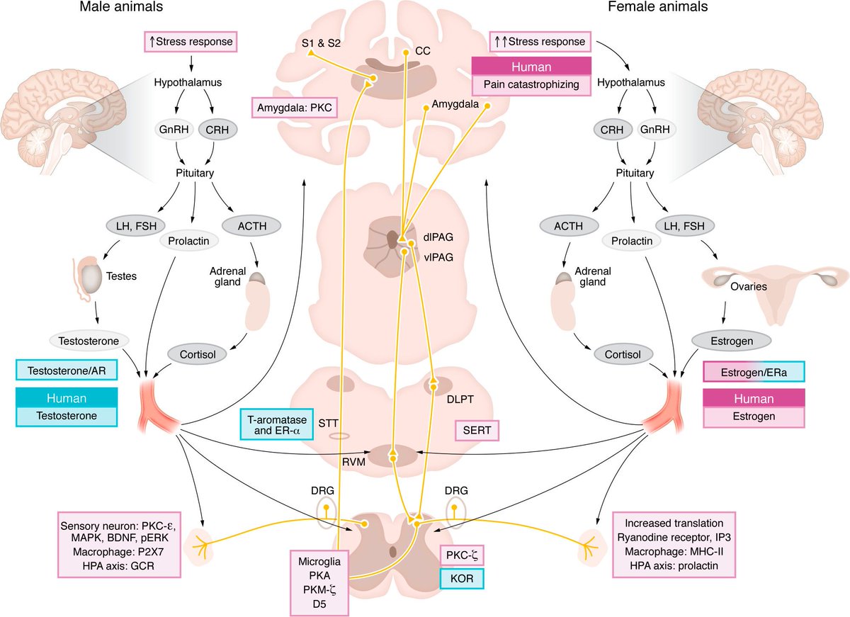 Journal of Clinical Investigation (@jclinicalinvest) on Twitter photo Women are disproportionately affected by chronic pain.
<a href="/ksluka0101/">Kathleen Sluka</a> <a href="/a2cps_pain/">A2CPS - Acute to Chronic Pain Signatures</a> <a href="/an_plumb/">Ashley Plumb</a> & <a href="/gioberardi1/">Giovanni Berardi</a> describe sex-specific mechanisms in the transition to chronic pain that may inform individualized approaches to pain management in both sexes. jci.org/articles/view/⦠Women are disproportionately affected by chronic pain.
<a href="/ksluka0101/">Kathleen Sluka</a> <a href="/a2cps_pain/">A2CPS - Acute to Chronic Pain Signatures</a> <a href="/an_plumb/">Ashley Plumb</a> & <a href="/gioberardi1/">Giovanni Berardi</a> describe sex-specific mechanisms in the transition to chronic pain that may inform individualized approaches to pain management in both sexes. jci.org/articles/view/ā¦