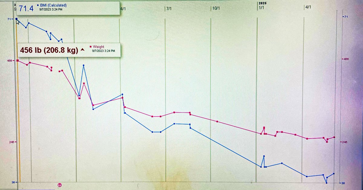18 months after gastric bypass bariatric surgery:

✴️ BMI from 71 to 40

✴️ Weight from 456 lbs to 255 lbs
