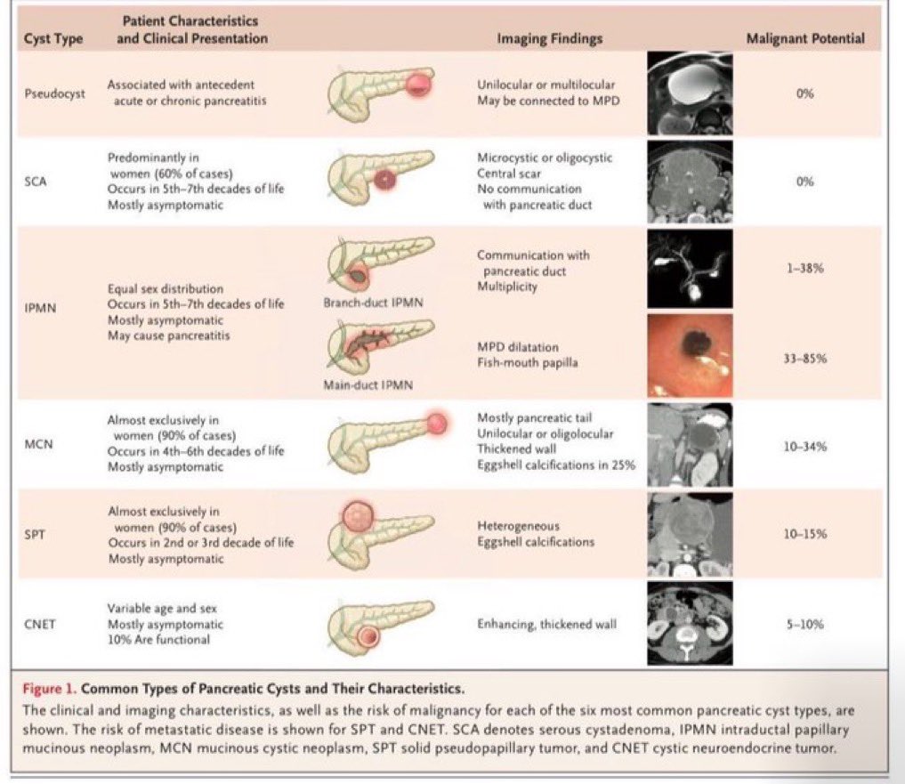 Pancreatic cysts