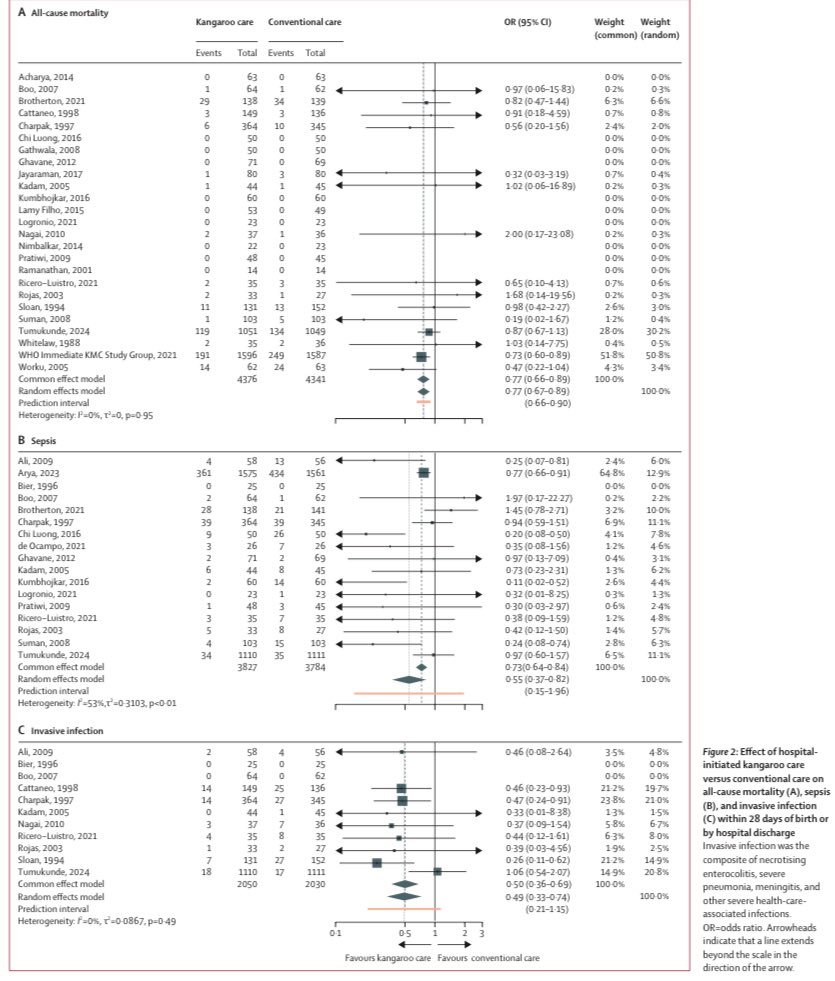 Abdul Razak (@drabdulrazak_md) on Twitter photo When we see parents doing kangaroo care, we should sincerely thank them as this simple act is saving lives!
New SRMA published in <a href="/LancetChildAdol/">The Lancet Child & Adolescent Health</a> confirms this intervention as high quality evidence in reducing death thelancet.com/journals/lanch…
<a href="/EBNEO/">Evidence-Based Neo</a> <a href="/ESPR_ESN/">European Society for Paediatric Research (ESPR)</a> <a href="/nicupodcast/">The Incubator Podcast</a> When we see parents doing kangaroo care, we should sincerely thank them as this simple act is saving lives!
New SRMA published in <a href="/LancetChildAdol/">The Lancet Child & Adolescent Health</a> confirms this intervention as high quality evidence in reducing death thelancet.com/journals/lanch…
<a href="/EBNEO/">Evidence-Based Neo</a> <a href="/ESPR_ESN/">European Society for Paediatric Research (ESPR)</a> <a href="/nicupodcast/">The Incubator Podcast</a>