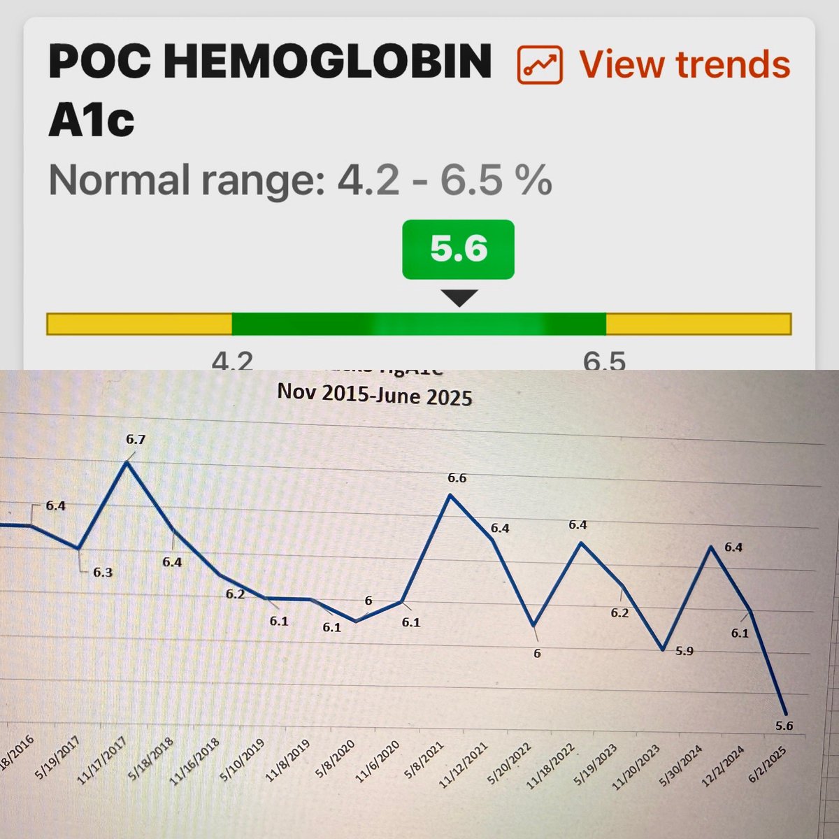 Ten year #afrezza user updating on best a1c yet, 5.6, so I’m normal again lol. Tresiba and afrezza is magic and if you haven’t tried #afrezza, it will change your life. Thank you <a href="/MannKindCorp/">MannKind</a> keep it going and hope pediatrics can use it soon! 
#insulin #diabetes #diabeteschat