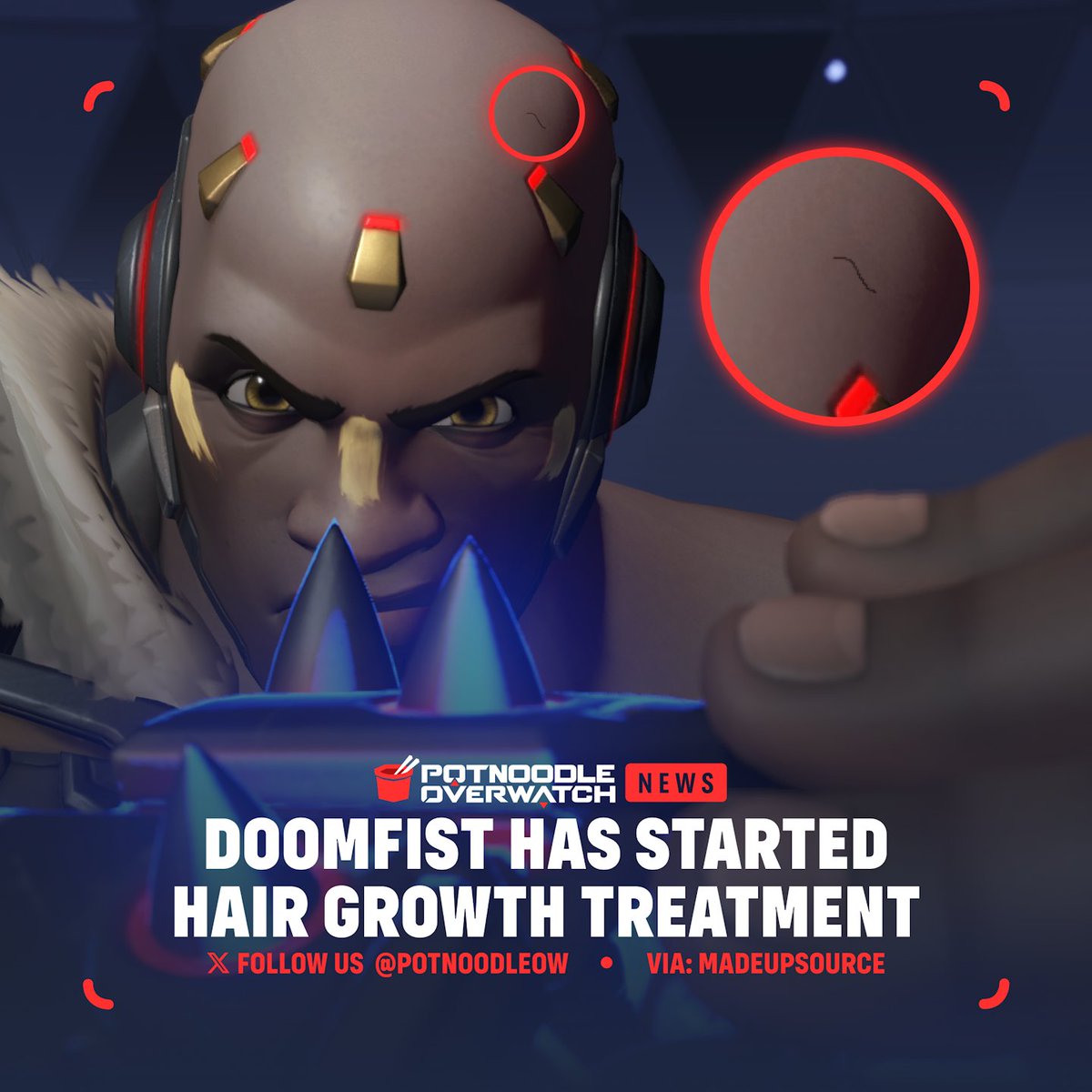 Doomfist from #Overwatch as started a brand new experimental hair growth treatment and is already seeing results 💇‍♂️