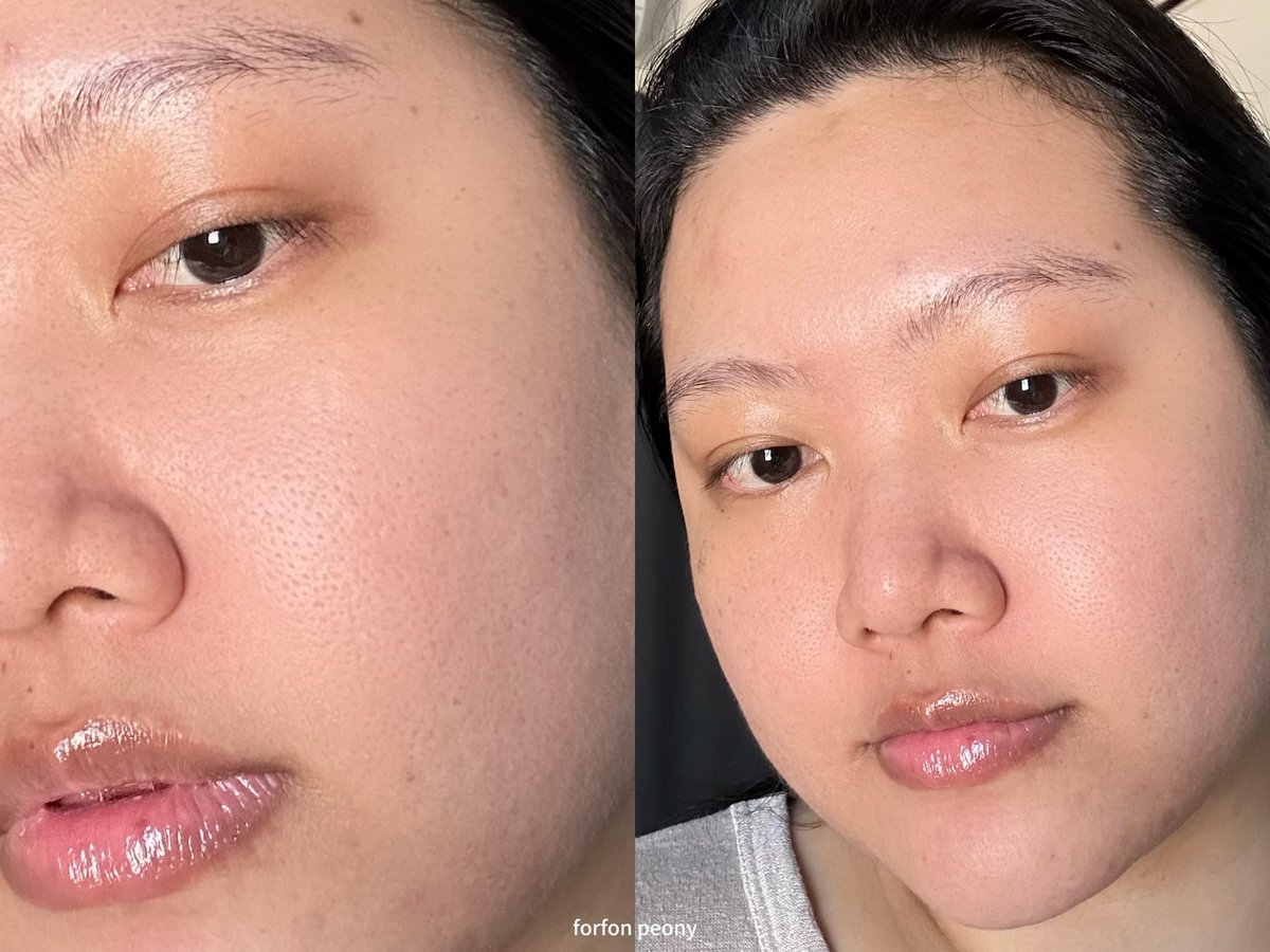 แนะนำจากใจเลยนะ ใครหน้าพัง ผิวมัน เป็นสิว ระคายเคืองง่าย มาซบอก amt ได้เลย!! แนะนำตัว emulsion มอยส์ปรับสมดุลน้ำกับน้ำมันใต้ผิว บาลานซ์ผิวเก่งมากกก!! 

ปกติเราใช้สูตร Light จะเหมาะกับผิวมัน ผิวผสม และผิวเป็นสิว เนื้อบางเบา ซึมไว ไม่เหนียวเหนอะ ตื่นมาหน้าไม่มัน เลิ้ปมากกก🫶🏻