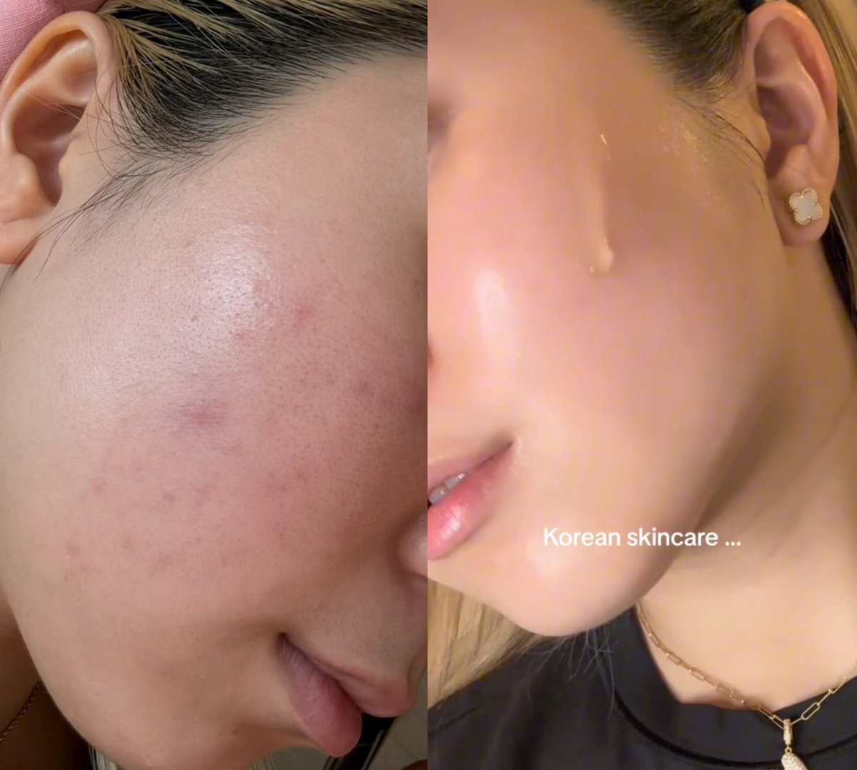 Korean skincare untuk perawatan wajah Glass skin ✨

A Thread