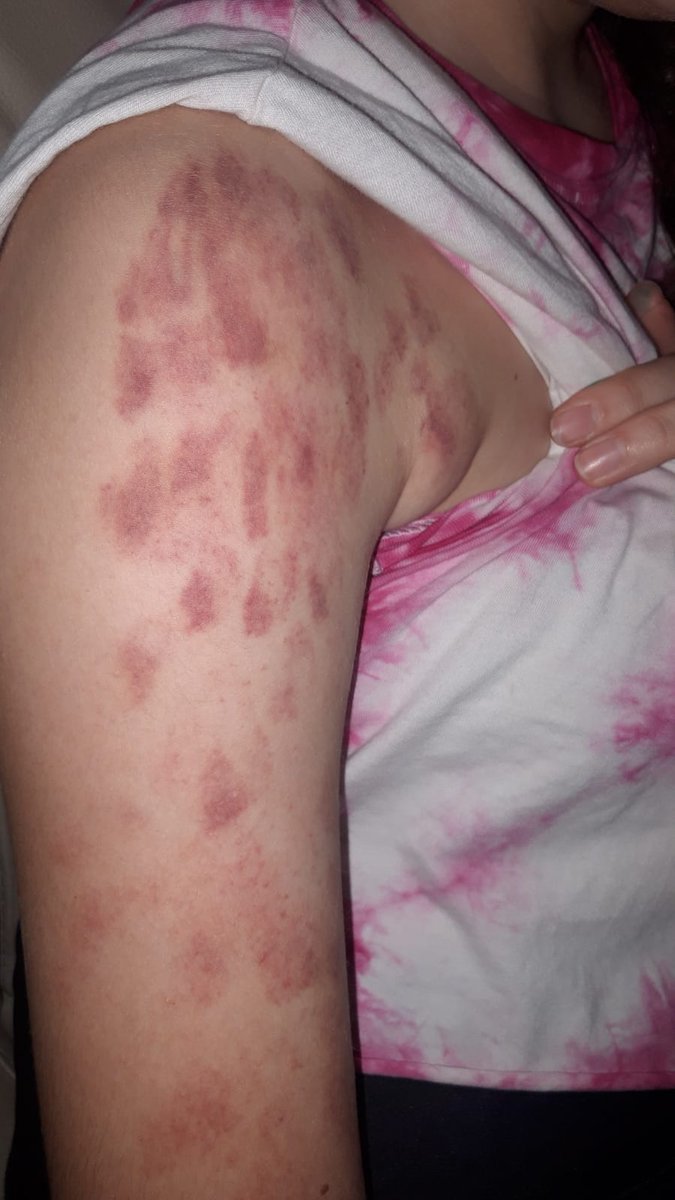 sepa tamer tweet media